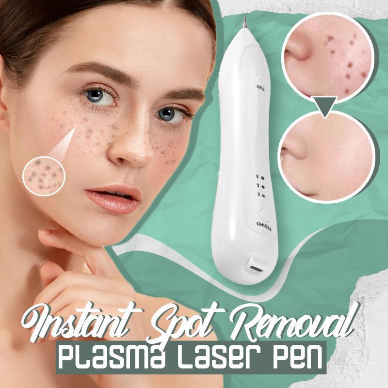 Instant Spot Removal Plasma Laser Pen