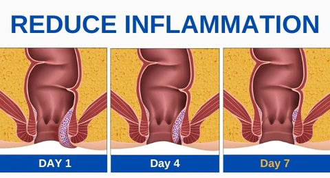 HappyBuns Hemorrhoid Treatment Wipes