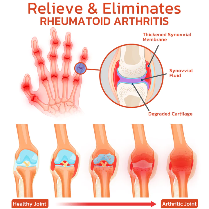 GFOUK DeerAntler Joint and Bone Therapy Balm