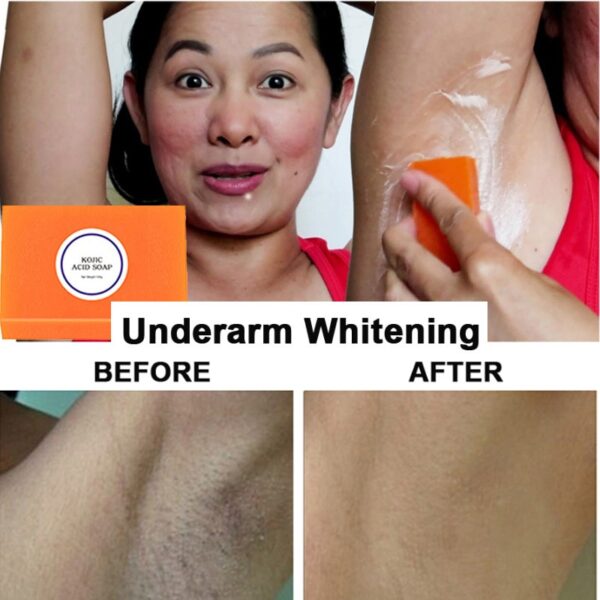 Kojic San Skin Lightening Soap