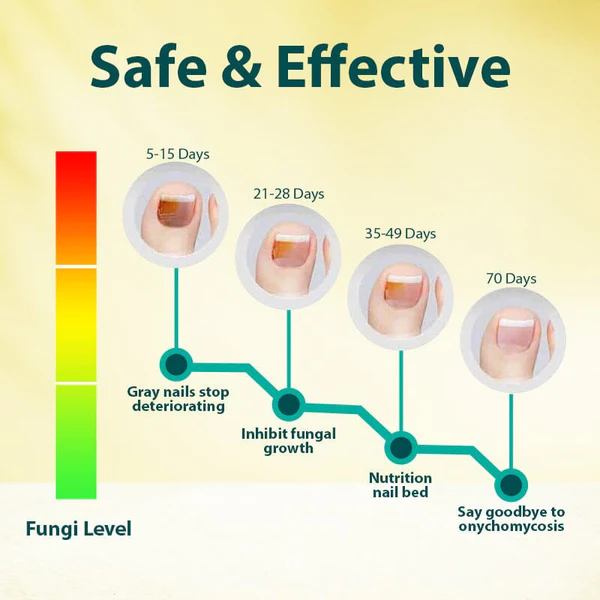 NailRestore Anti-Fungal Treatment Essence