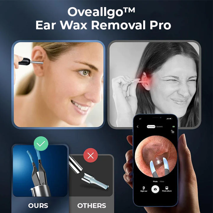 Oveallgo Ear Wax Pro with HD-Camera