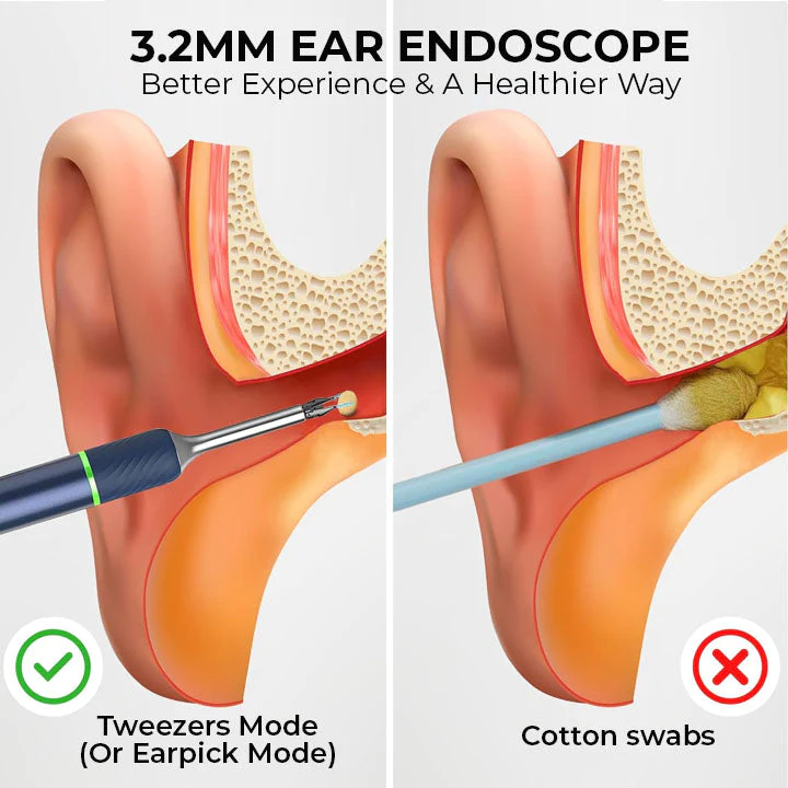 Oveallgo Ear Wax Pro with HD-Camera