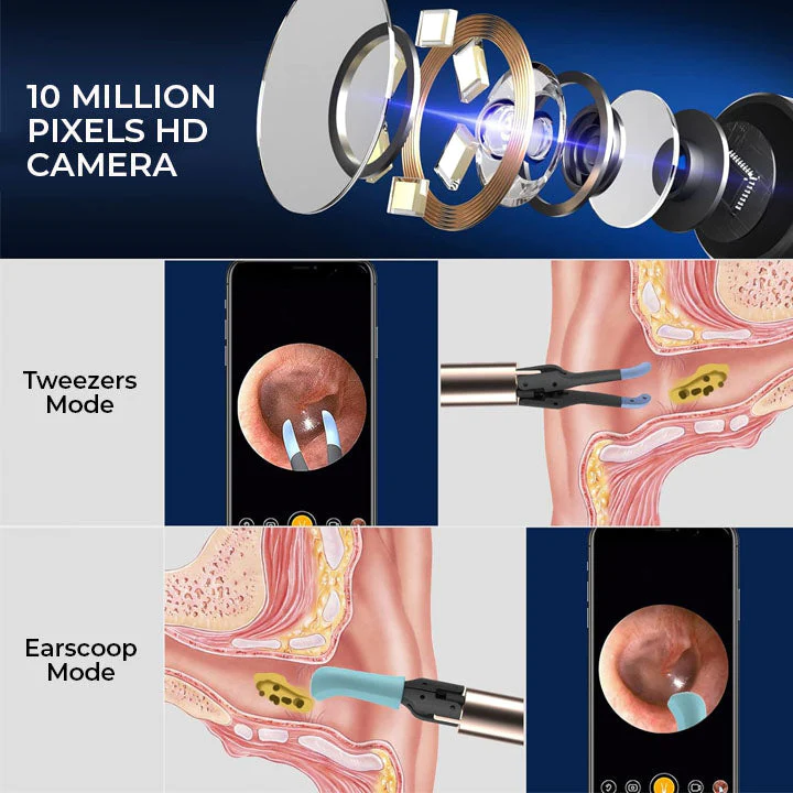 Oveallgo Ear Wax Pro with HD-Camera