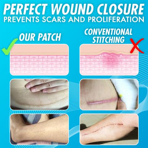 Recovery Closure Enhancing Zipped Up Patch