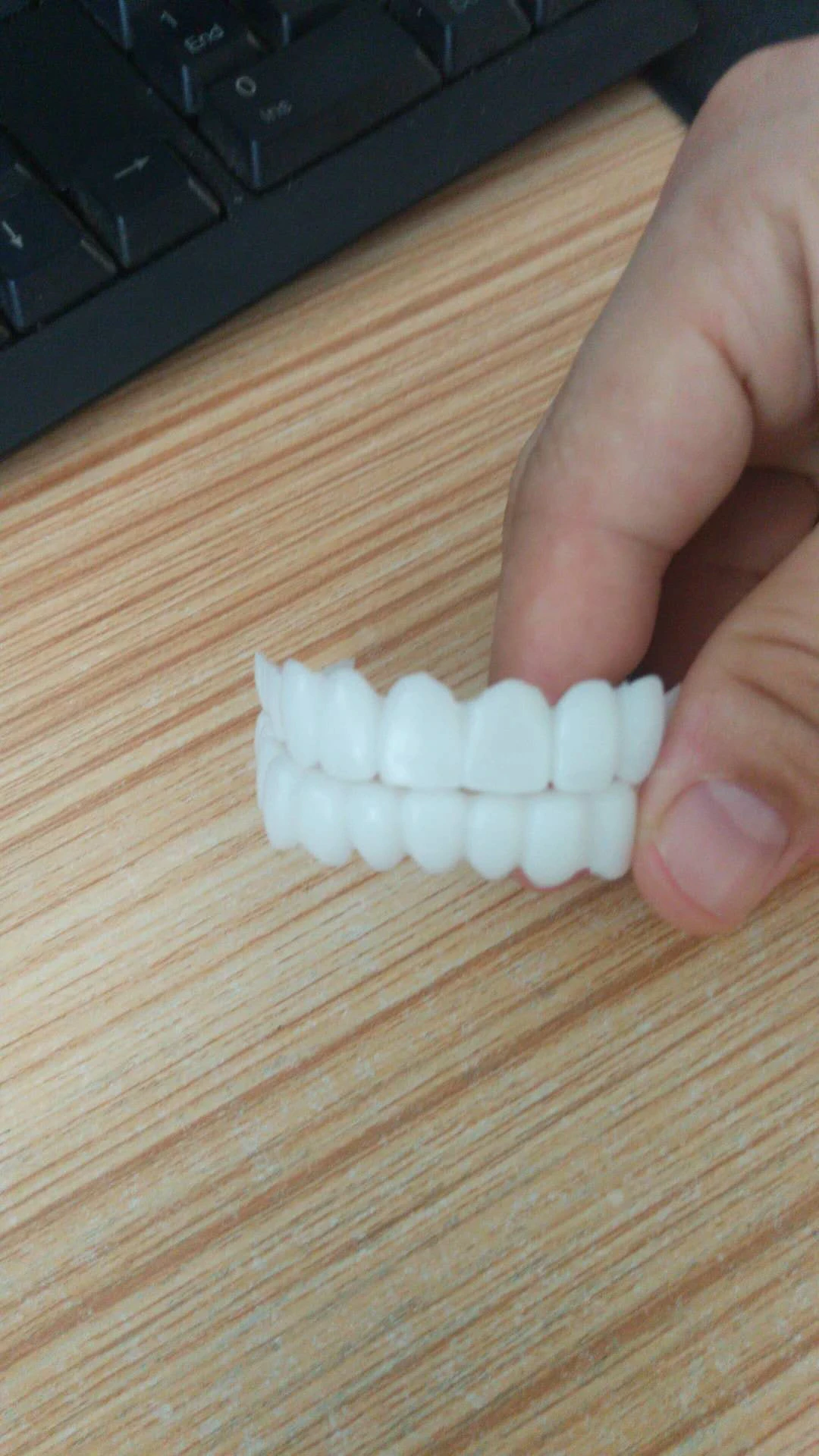 Adjustable Snap-On Dentures