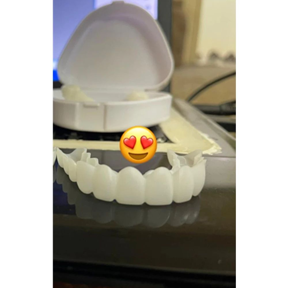 Adjustable Snap-On Dentures