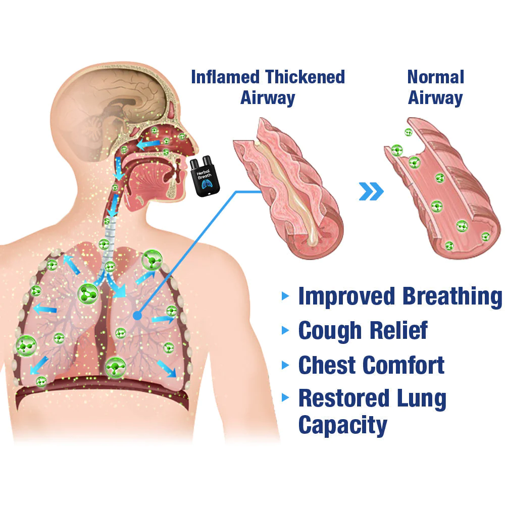 GFOUK HerbalBreathe Respiratory Cleansing Aerosolizer