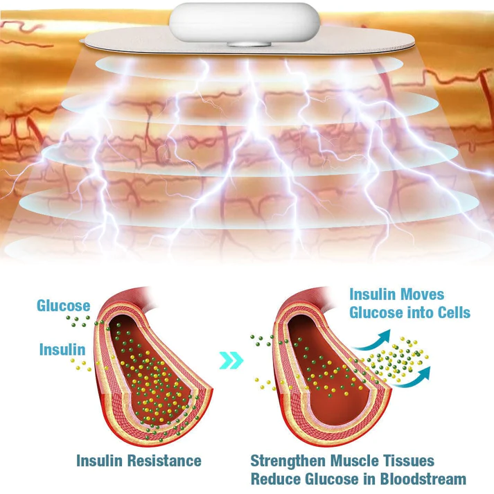 GFOUK GlucoCare Electric Pulse Balancing Device