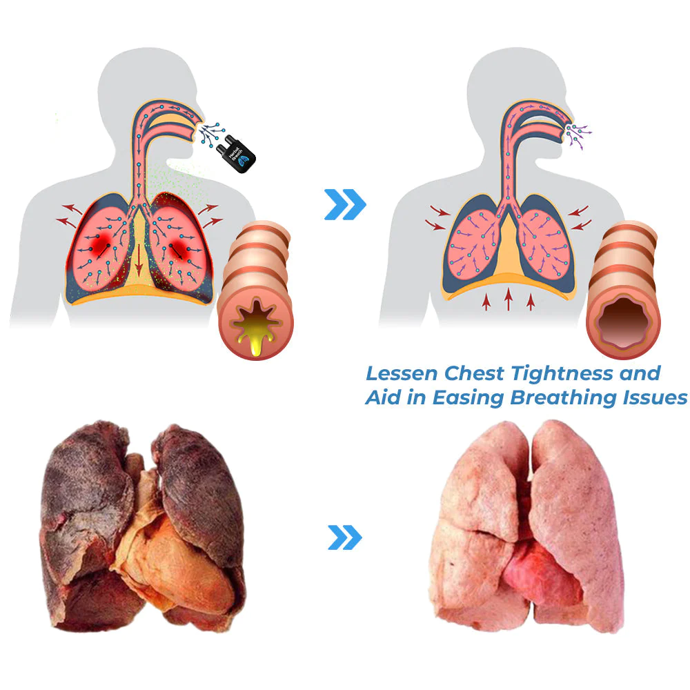 GFOUK HerbalBreathe Respiratory Cleansing Aerosolizer