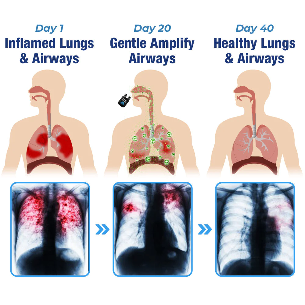 GFOUK HerbalBreathe Respiratory Cleansing Aerosolizer