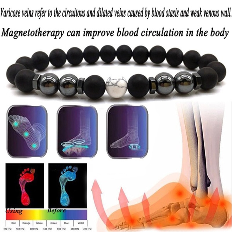 Anti Varicose And Swelling Magnetotherapy Anklet