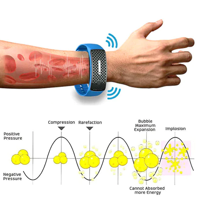 Cishx South Korea Matteo Ultrasonic Body Shape Wristband Pro