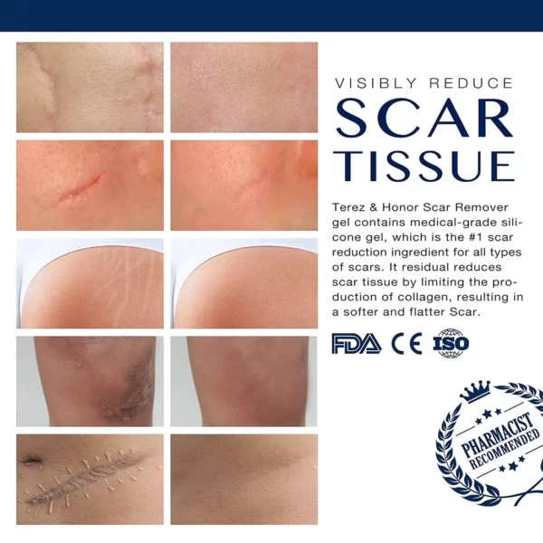 MEDix Advanced Silicone Scar Gel