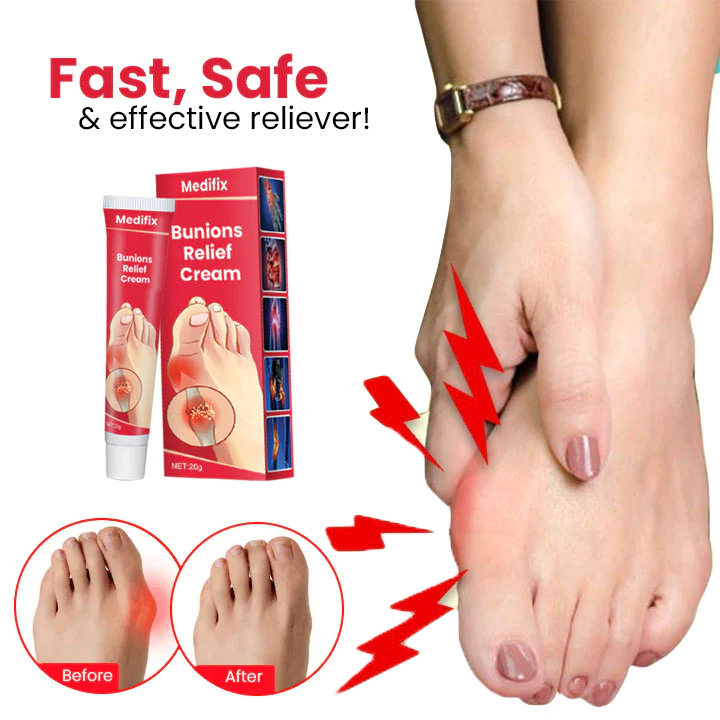 DigiEase Bunions Relief Cream