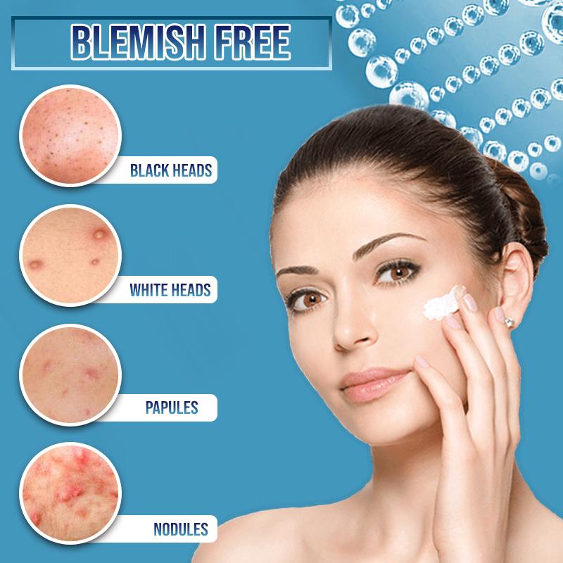 Miracle BlemishFree SkinCream