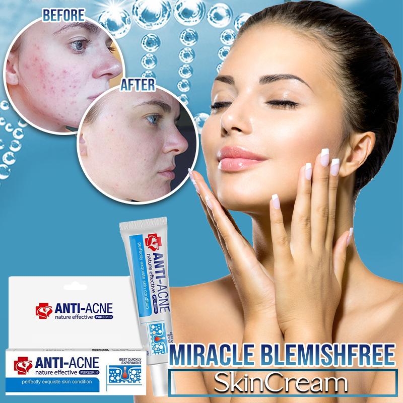 Miracle BlemishFree SkinCream