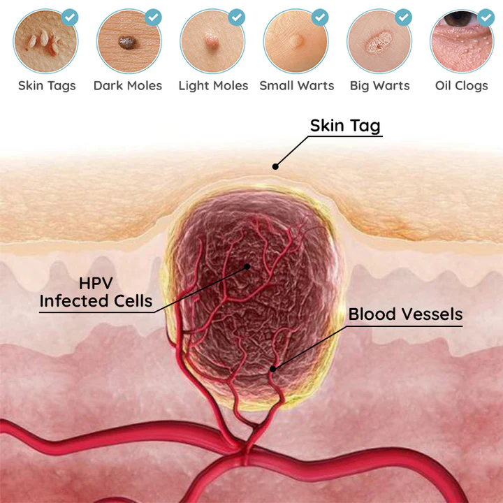 MiracleTag MicroDarts SkinTAG Blemish Patches