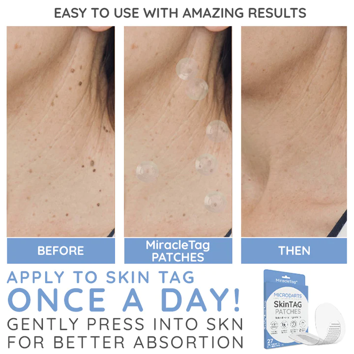 MiracleTag MicroDarts SkinTAG Blemish Patches