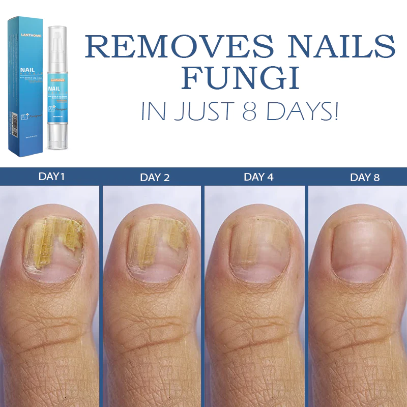 NailRenewal FungusTreatment Pen