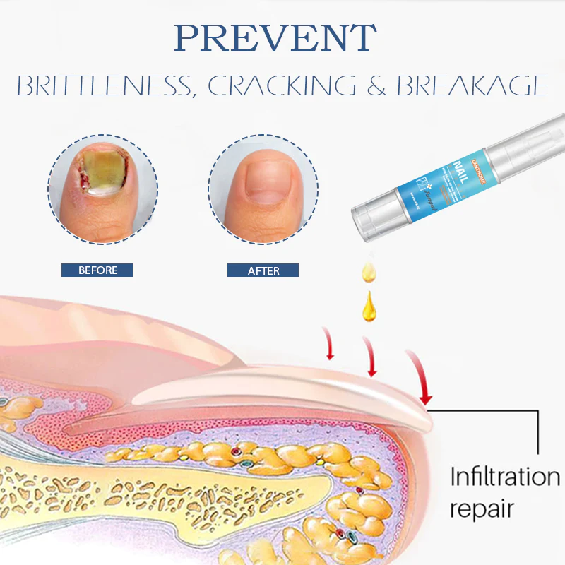 NailRenewal FungusTreatment Pen