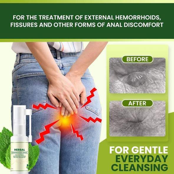 Natural Herbal Hemorrhoids Spray