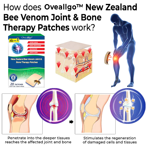 Oveallgo New Zealand Bee Venom Joint & Bone Therapy Patches