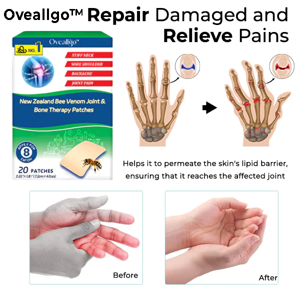 Oveallgo New Zealand Bee Venom Joint & Bone Therapy Patches