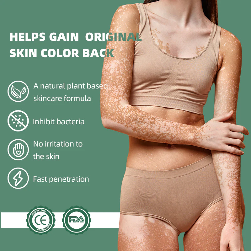 Canada Polumna Vitiligo Relief Spray