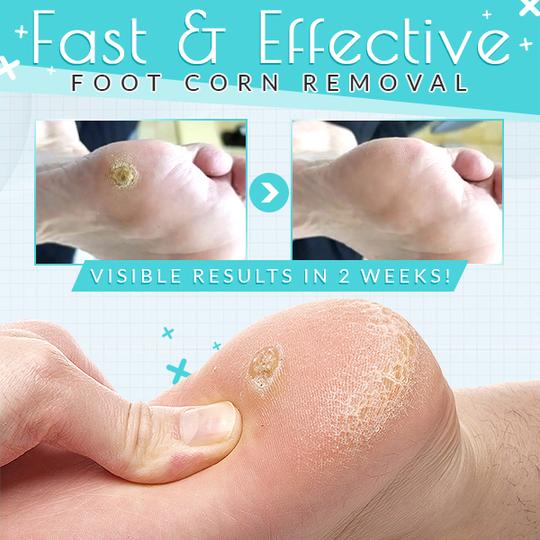 OneStep Corn Removal Gel