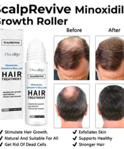 Oveallgo ScalpRevive Minoxidil Growth Roller