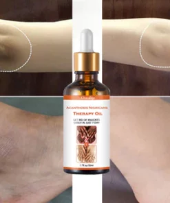 Oveallgo Acanthosis Nigricans Therapy Oil