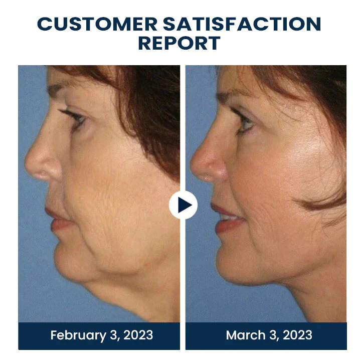 Oveallgo EMSPulse V-Face Sculpting Device