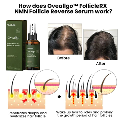 Oveallgo FollicleRX NMN Follicle Reverse Serum