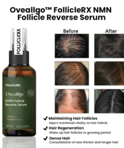 Oveallgo FollicleRX NMN Follicle Reverse Serum