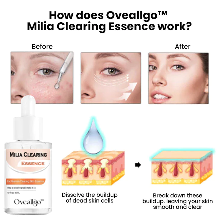 Oveallgo Milia Clearing Essence