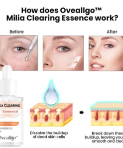 Oveallgo Milia Clearing Essence