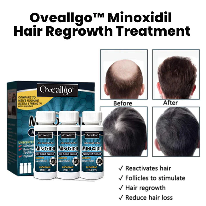 Oveallgo Minoxidil Hair Regrowth Treatment