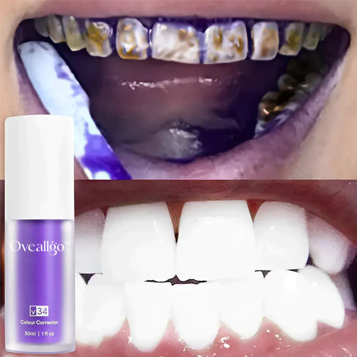 Oveallgo Deluxe Herbal Teeth Whitening Mousse