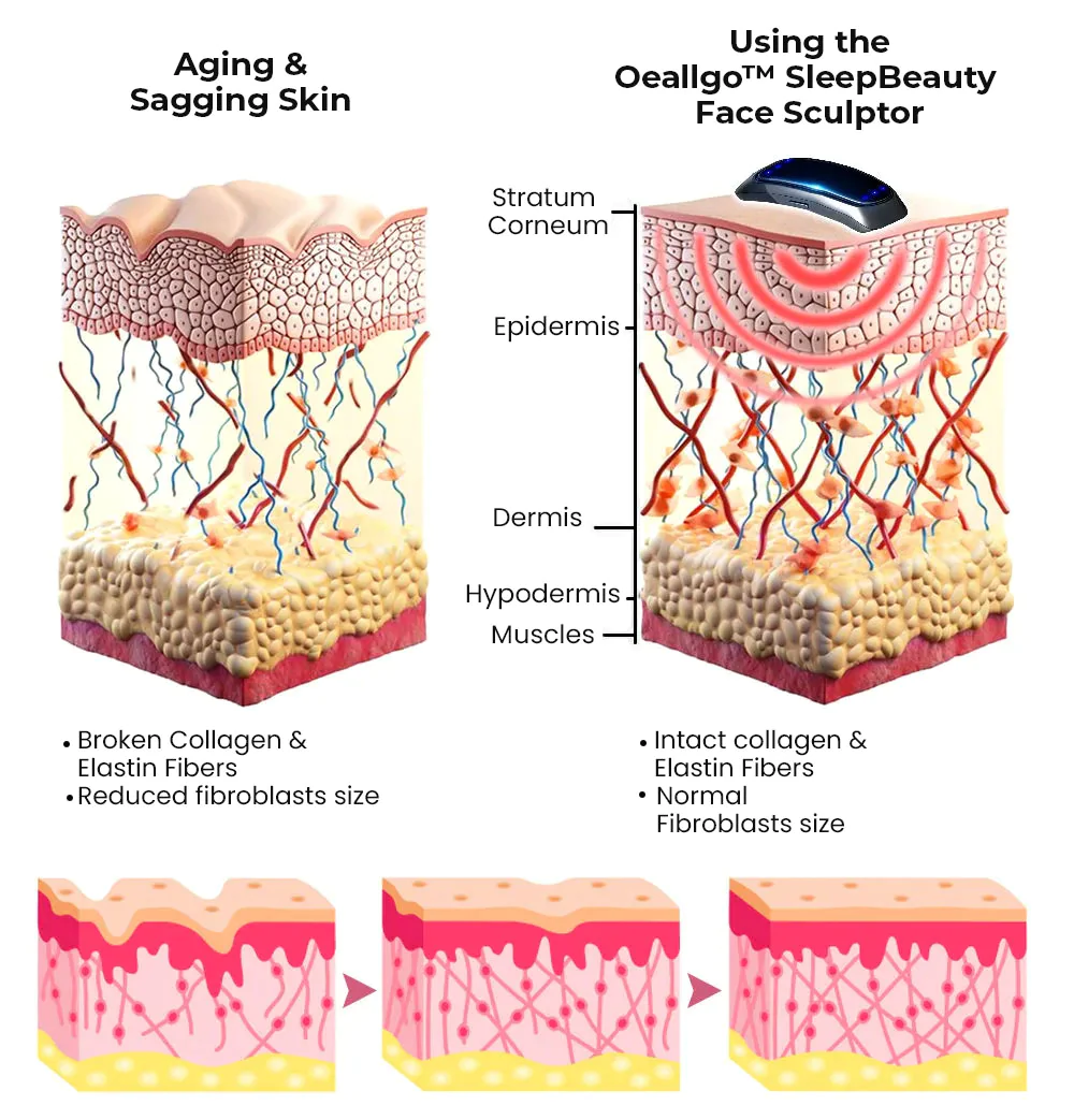 Oveallgo SleepBeautyPlus Face Sculptor