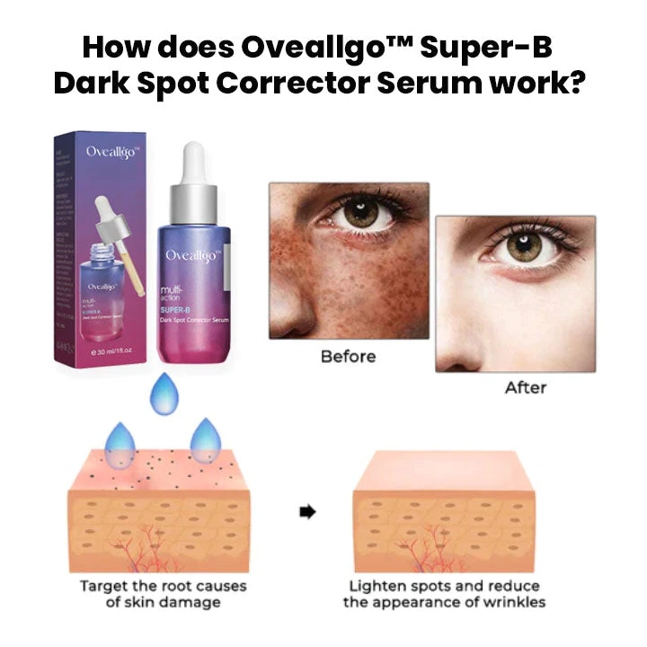 Oveallgo Super-B Dark Spot Corrector Serum