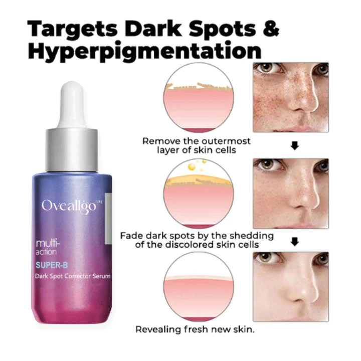 Oveallgo Super-B Dark Spot Corrector Serum