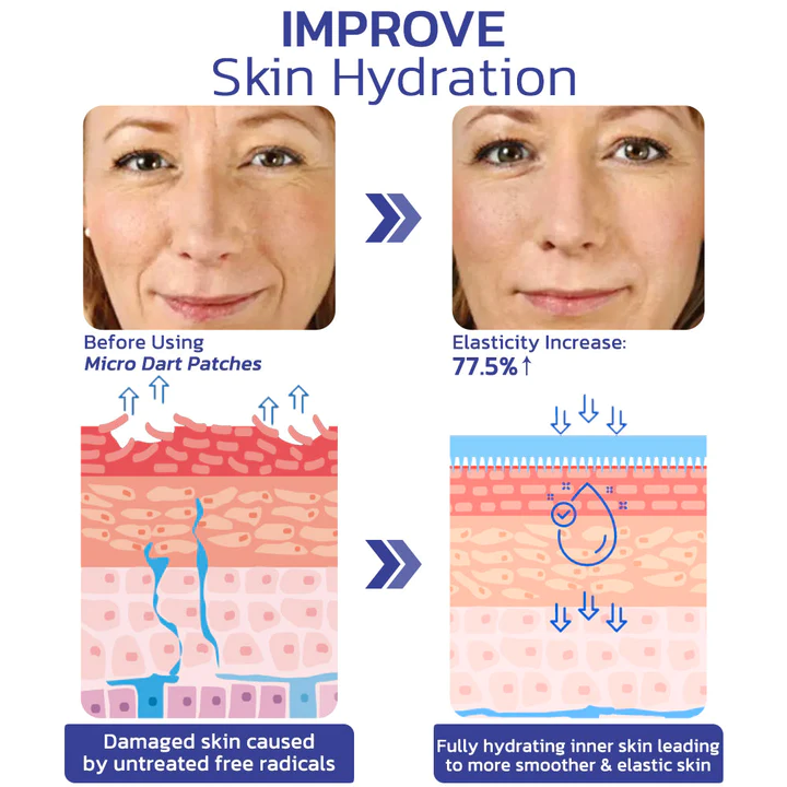 flysmusTargetline Hyaluronic Acid Micro Dart Patches