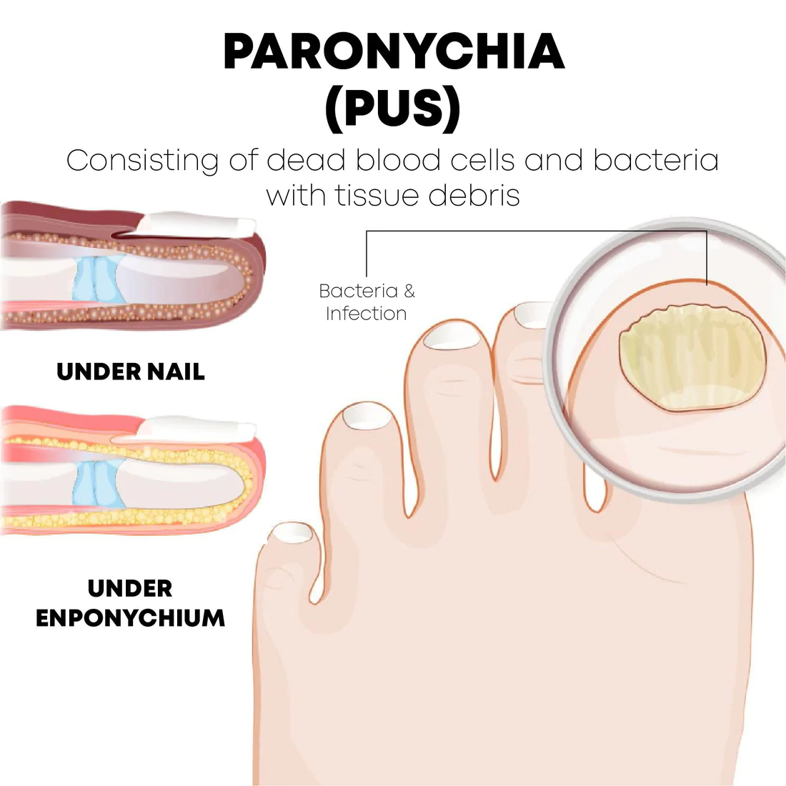 NAILTastic Anti Paronychia Aid Oil