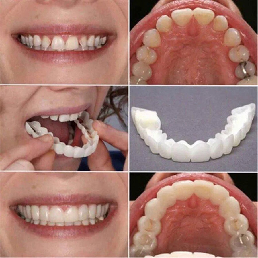 Magic Teeth Brace