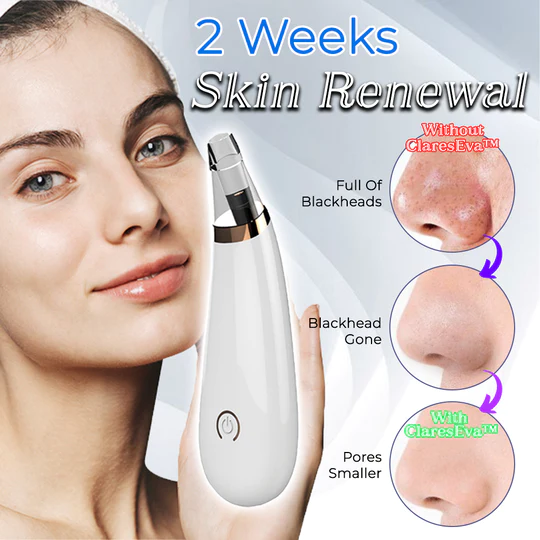 Pore Vacuum Cleaner For Blackheads