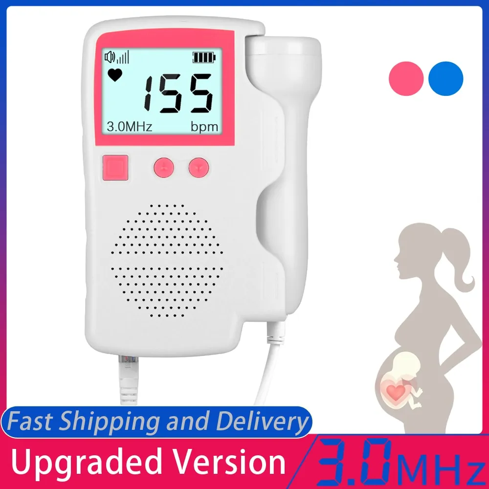 Prenatal Fetal Doppler