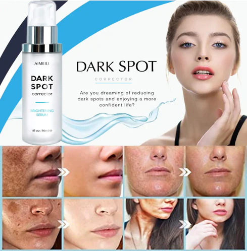 Aimeili Dark Spot Corrector for Face and Body