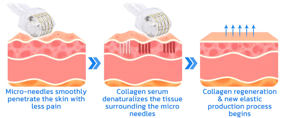 flysmus BoLiftox PockmarksTreat Collagen Astaxanthin Roller