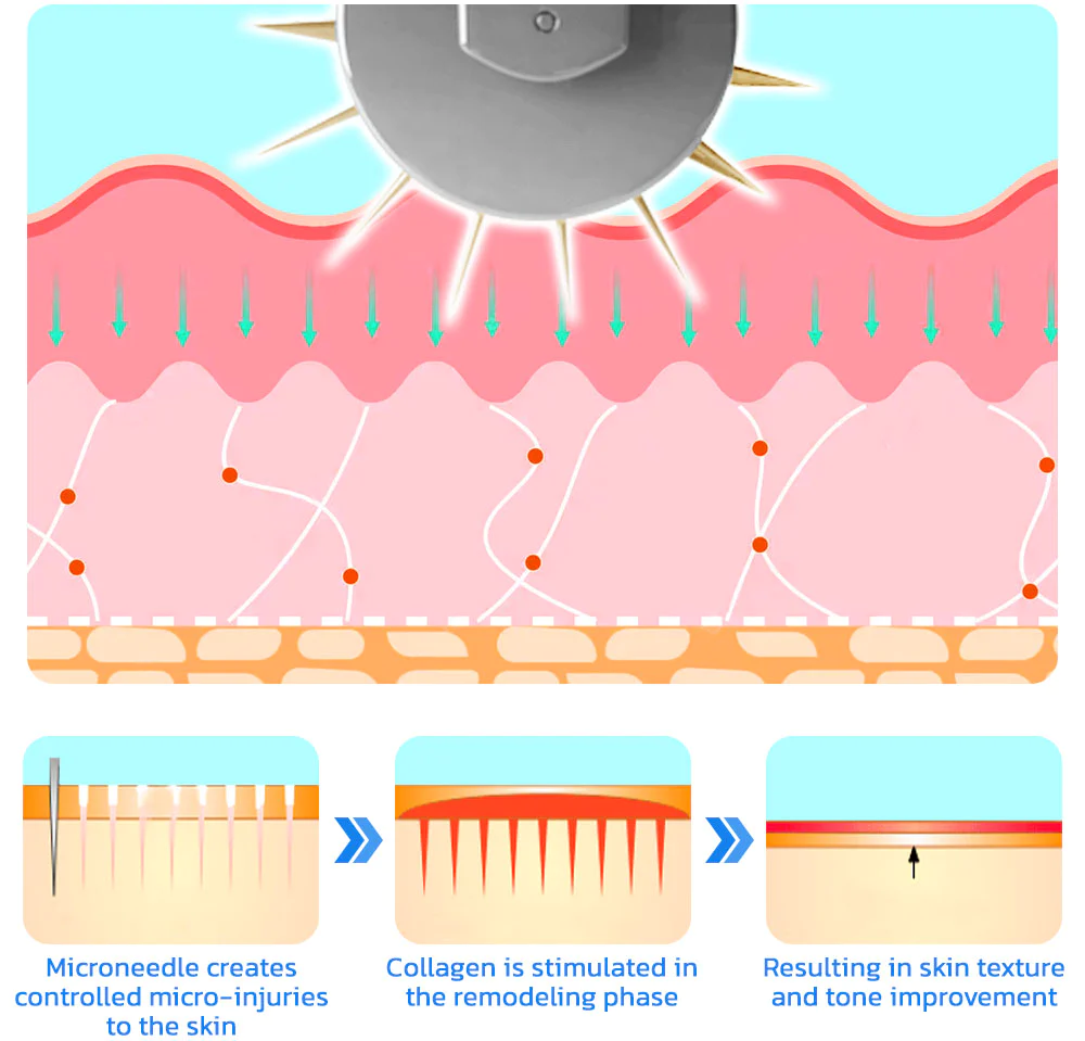 flysmus BoLiftox PockmarksTreat Collagen Astaxanthin Roller